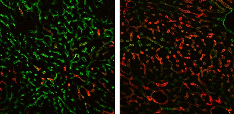 Die Immunfluoreszenzfärbung für Endomucin (grün) und LYVE-1 (rot) illustriert Veränderungen der Blutgefäße nach GATA4-Verlust in der fibrotischen Leber (li.). Hier zeigt sich Endomucin vermehrt und LYVE-1 vermindert im Vergleich zur gesunden Leber (re.).