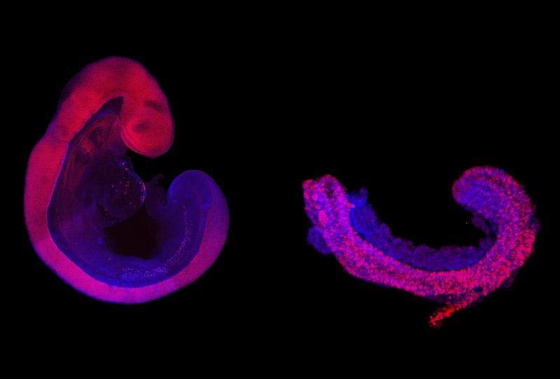 Vergleich eines neun Tage alten, in der Gebärmutter gewachsenen Mausembryos (links) und einer rumpfähnlichen Struktur (rechts). Das Neuralrohr, das schließlich das Rückenmark bildet, ist pink gefärbt. Alle anderen Gewebe sind blau gefärbt.