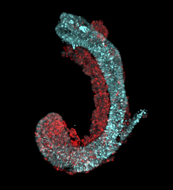 Fluorescent microscopic image of a Trunk-Like-Structure that has been generated with an advanced cell culture technique and is highly similar to the trunk of a mouse embryo. It has been grown from mouse embryonic stem cells.