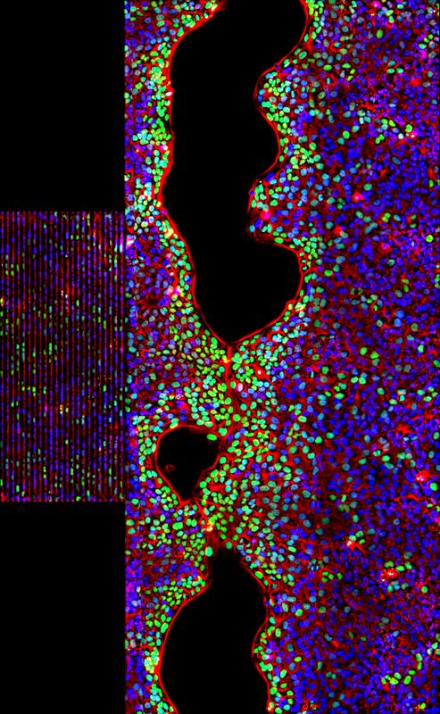 Dreifarbenaufnahme stimulierter Zellen auf einem SAW-Chip. Rot: Phasenkontrastbild der Zellen, blau: Zellkerne, grün: Zellkerne von Zellen, die sich während der Schallbehandlung geteilt haben. 