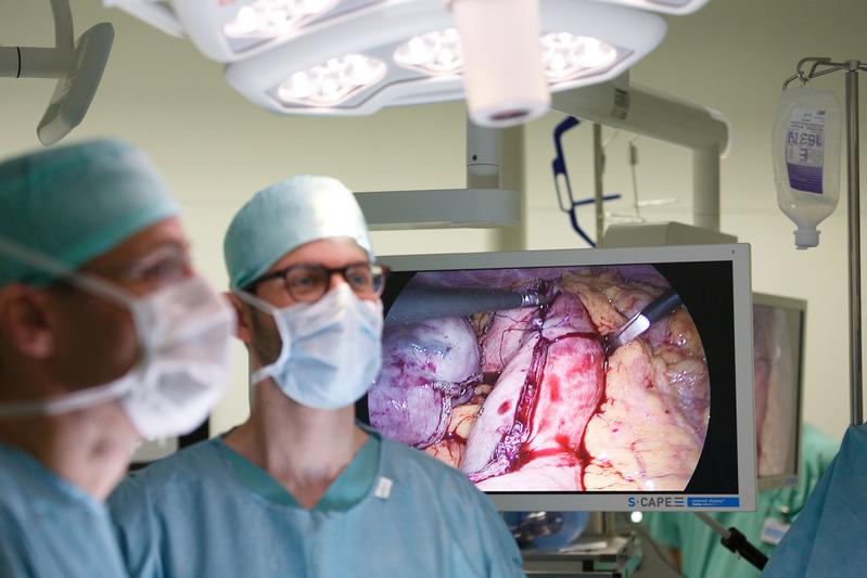 Minimalinvasive Tumoroperationen im Bauchraum sollen mithilfe einer speziellen App künftig noch sicherer werden. 