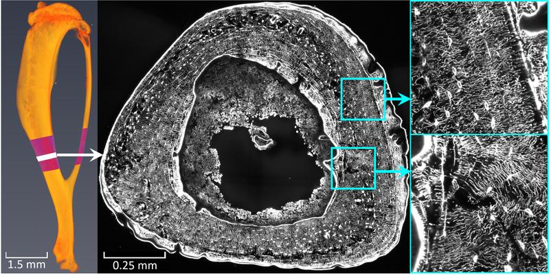 Mäuseknochen: Knochenschnitt unter Laser-Scanning-Mikroskop - vergrößerte Abbildung der dichten Netzwerkarchiktektur und des Flüssigkeitsstroms