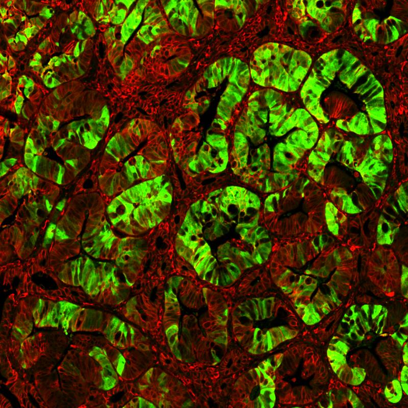 Expandierende Krebsstammzellen (grün) in einem Darmtumor mit onkogen aktiviertem Wnt/beta-Catenin Signalweg (rot). 