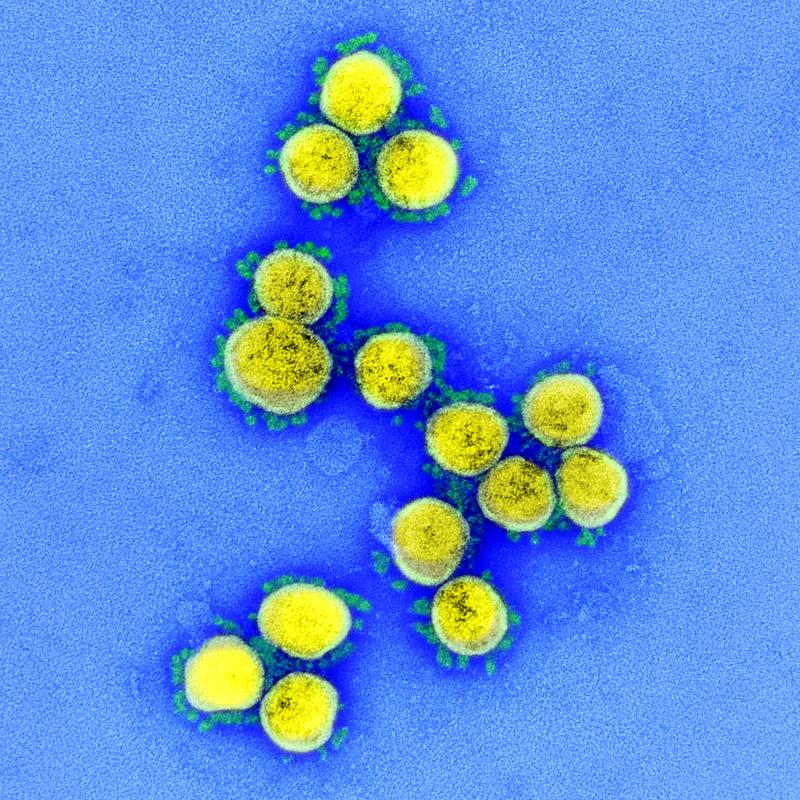 SARS-CoV-2: Viruspartikel im Elektronenmikroskop