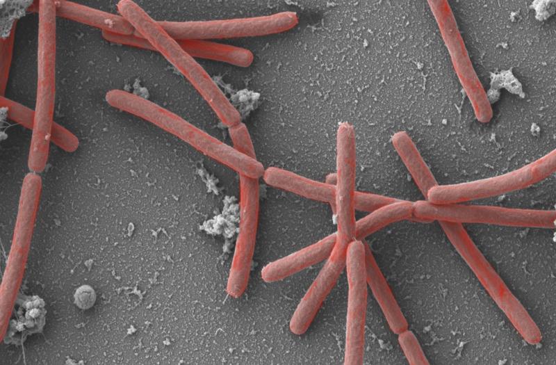 Die Mikrobe des Jahres 2021, Methanothermobacter, 30.000fach vergrößert 