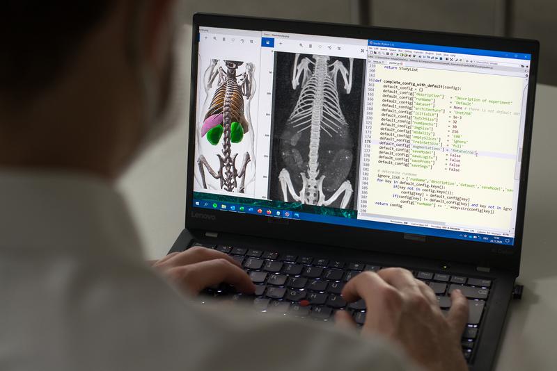 Dank künstlicher Intelligenz ist die AIMOS-Software in der Lage, auf dreidimensionalen Graustufenbildern Knochen und Organe zu segmentieren, was die anschließende Auswertung erheblich erleichtert.
