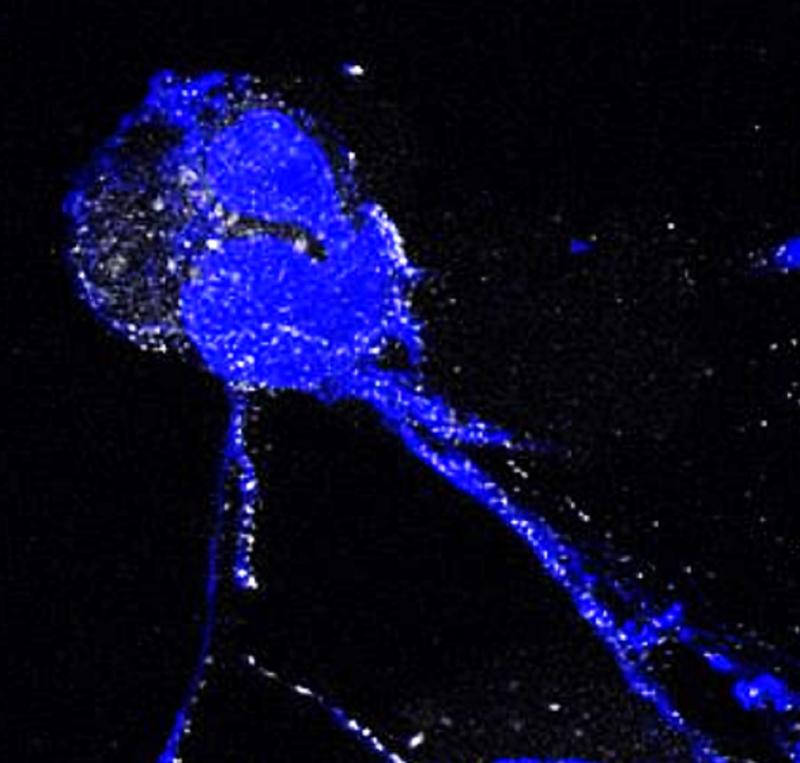 Eine Immunzelle setzt ein NET (Neutrophil Extracellular Trap) frei, das aus DNA (in blau) und Proteinen besteht. Weiß eingefärbt sind hier bestimmte Proteine, die Histone.