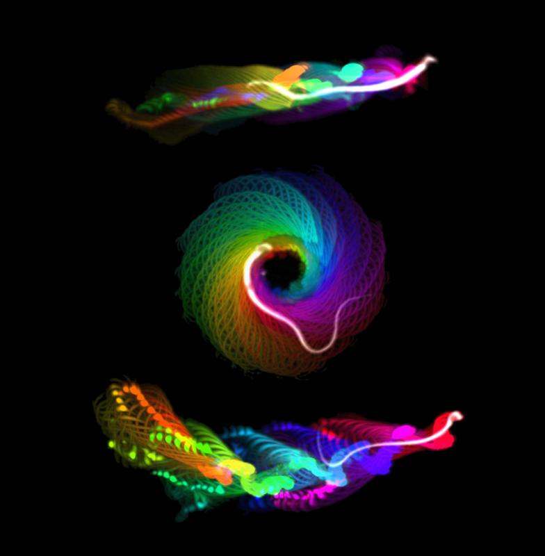 Computergestützte Analyse lichtmikroskopischer Daten, die den linearen Schwimmweg eines normalen Spermas (oben) & die abnormen kreisförmigen und diagonalen Schwimmwege der mutierten Spermien (Mitte und unten) zeigen, denen die Tubulin-Glycylierung fehlt.