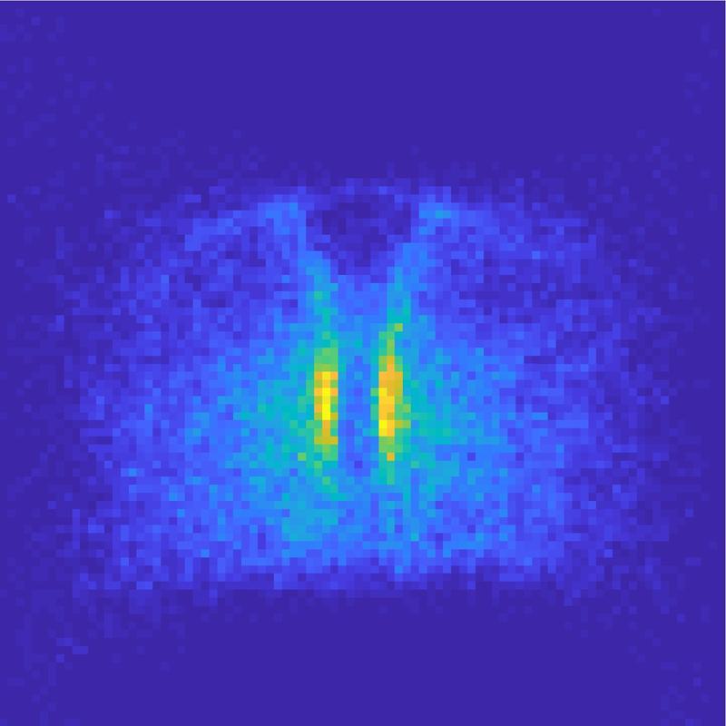 Forscher legten Mikroskopiebilder von Hunderten Zebrafischembryonen digital übereinander. So konnten sie Muster in der Urkeimzellwanderung erkennen und Gewebe identifizieren, die diese beeinflussen.