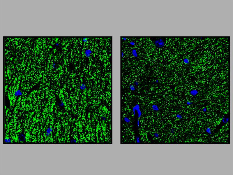 Hippocampus: In den transgenen Mäusen (Pigv341E; rechts) ist eine geringere Anzahl von Vesikeln (grün) vorhanden, in denen Neurotransmitter gespeichert sind als bei den Kontrolltieren (links). Dies könnte für den synaptischen Defekt verantwortlich sein.