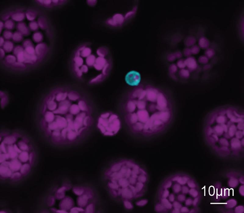 Isolierte Gefäßzellen von Arabidopsis; die Phloem-Parenchymzelle sind in Cyan markiert. 
