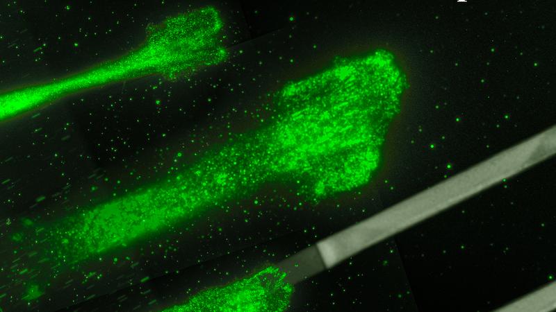 Krebszellen wandern auf Glycoproteinstreifen: Diese Streifen haben ähnliche Eigenschaften wie Gleitschienen und erleichtern die Kontrolle und Untersuchung von Zellbewegungen. 
