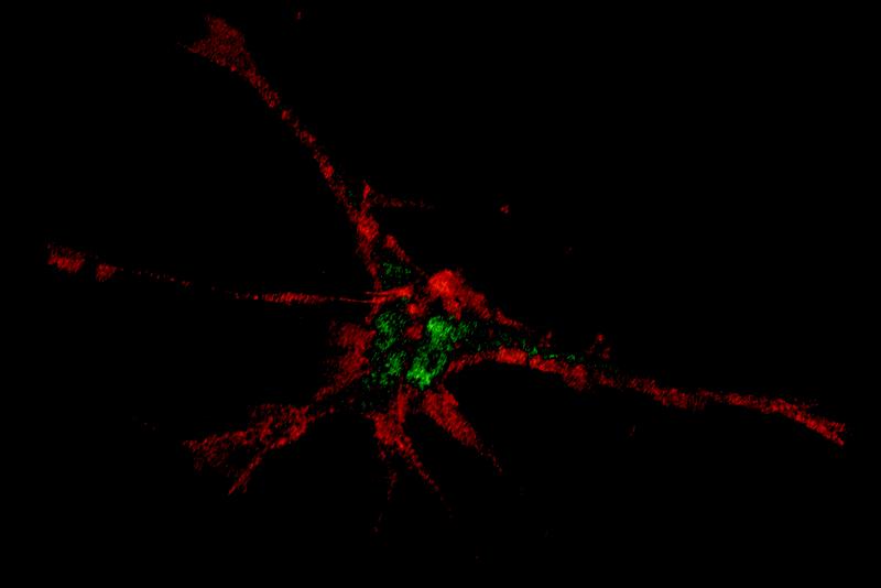  Magnetisch fanden die Nanopartikel ihren Weg in die Spitzen der Fortsätze von Nervenzellen. 