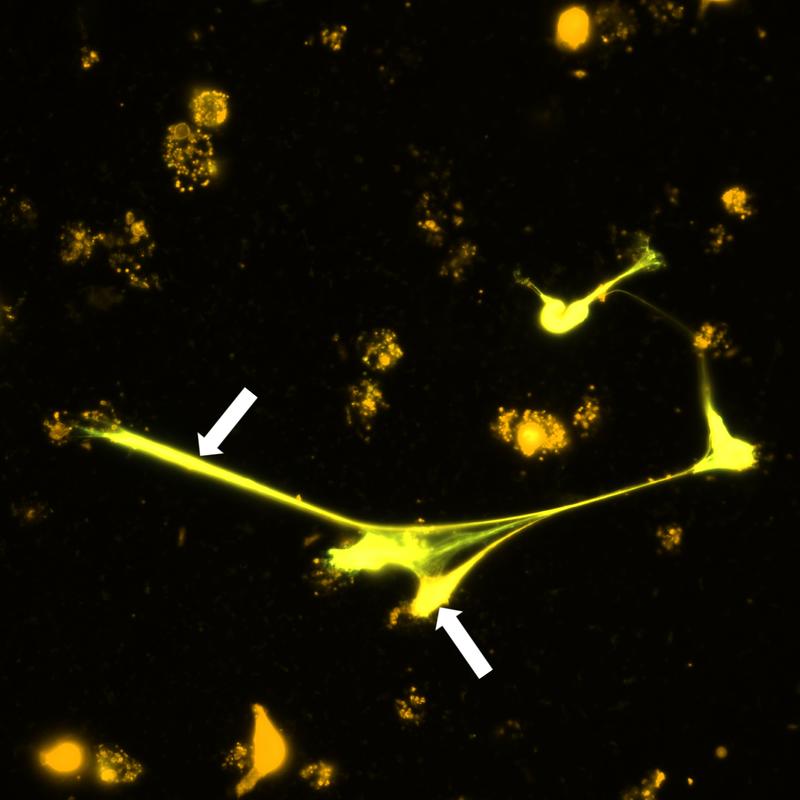 Eosinophile Granulozyten sind in der Lage, DNA-Netze auszuschütten und Mikrofilarien damit einzufangen. Die Fluoreszenzmikroskopieaufnahme zeigt die DNA-Netze (orange angefärbt, Pfeile).