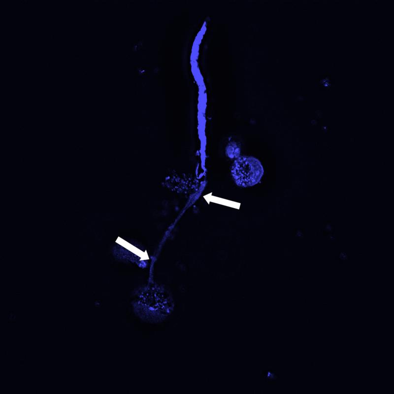 Die Fluoreszenzmikroskopieaufnahme zeigt, wie eine Mikrofilarie (oben) von den DNA-Netzen (blau angefärbt, Pfeile) der Eosinophilen Granulozyten (rundliche Strukturen) eingefangen wird.