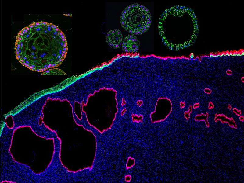 Image of human cervix tissue and organoids derived from ectocervical stratified squamous (green) and endocervical columnar (red) epithelial stem cells. 