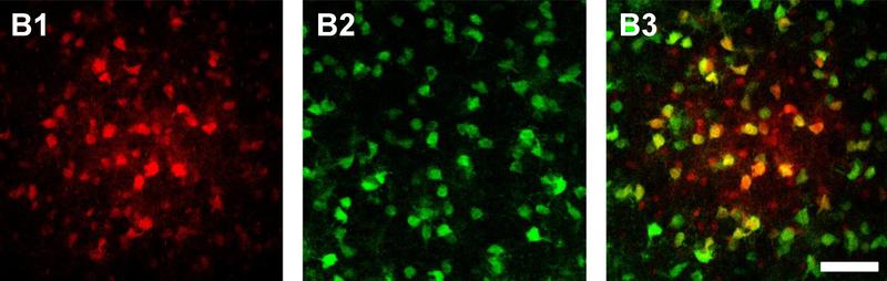 Wird ein Astrozyt im Thalamus mit Farbstoff gefüllt, diffundiert dieser in benachbarte Zellen des Netzwerks (rot). Darunter sind viele Oligodendrozyten (grün), wie die Überlagerung (B3, gelb) zeigt.