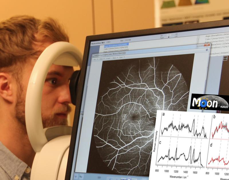 Das Forscherteam baut ein Gerät, an dem Patientinnen und Patienten ihr Auge berührungsfrei abrastern lassen können und wenige Minuten später eine Diagnose erhalten.  