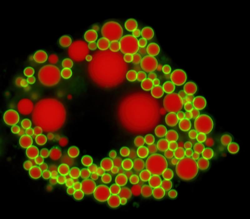 Fat droplets in a cell. 