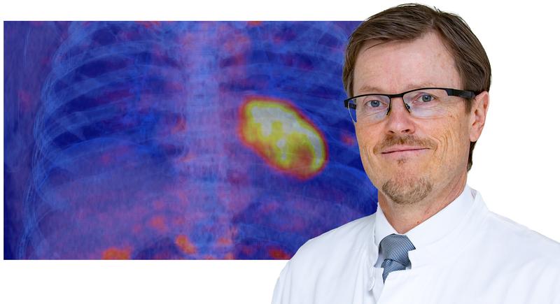 Professor Bengel in front of a PET/CT image of the chest of a patient after a heart attack. The yellow signal in the heart region shows the activated fibroblasts.