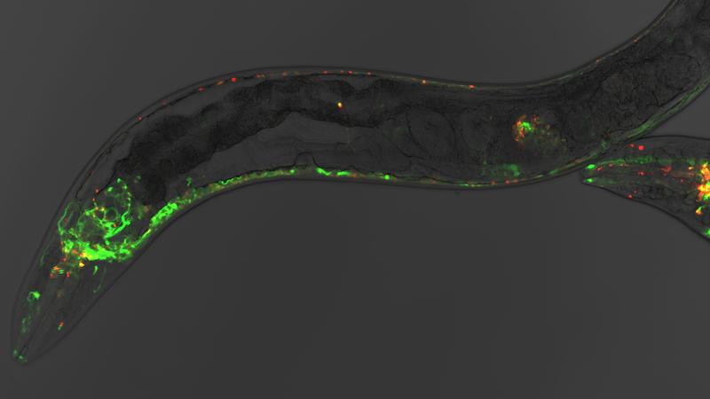 Der Fadenwurm Caenorhabditis elegans ist auf molekularer Ebene identisch zum Menschen. Bei der Alzheimer-Forschung spielt er eine wichtige Rolle. F