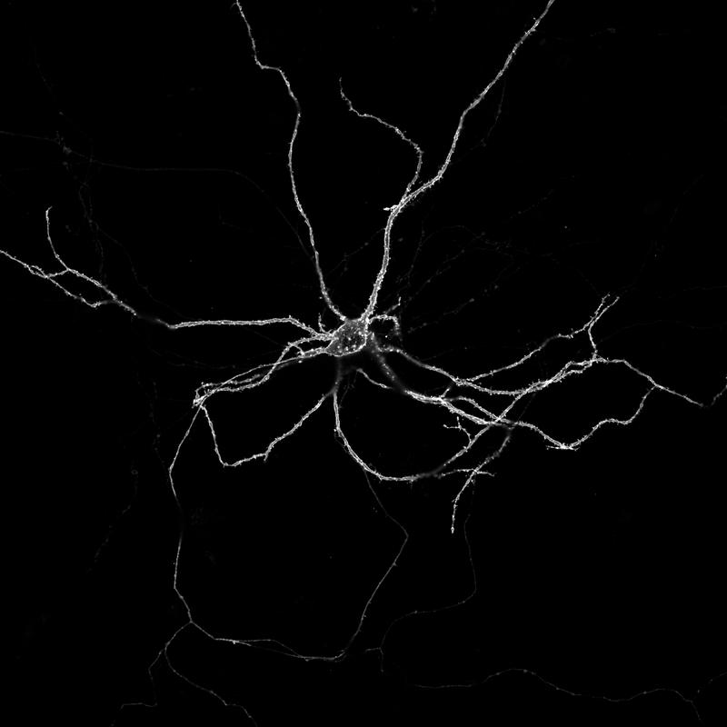 Image of a living nerve cell grown in the lab: The membrane surrounding it glows brightly because the fluorescent protein is on its outside. 