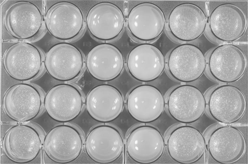 In einer Multiwell-Platte können Forschende gleichzeitig 24 Bakterienstämme darauf testen, ob sie von Amöben gefressen werden. Wenn ein Bakterium sich als fressbar erweist, entwickeln die Amöben Fruchtkörper, die man als kleine Punkte erkennen kann.