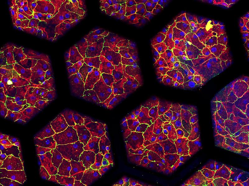 Eingefärbte Patientenzellen, die auf einer «Lunge auf Chip» der zweiten Generation kultiviert wurden.