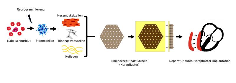 Abbildung: Prozess von Nabelschnurblut zur Herzpflaster-Implantation. 