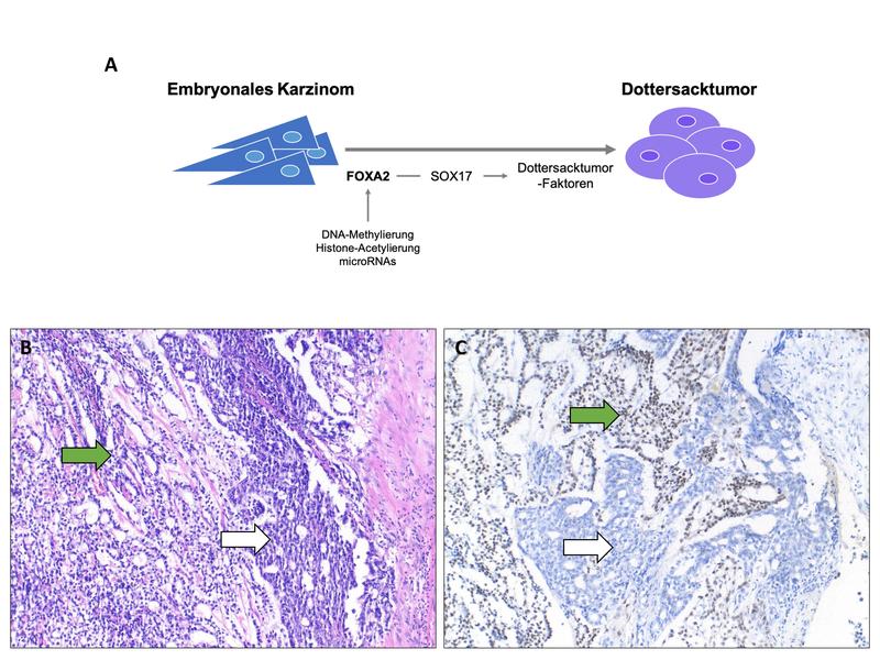 Die Bildung von Dottersacktumoren aus embryonalen Karzinomen könnte das Ergebnis einer durch die Mikroumgebung ausgelösten Hochregulation von FOXA2 sein.