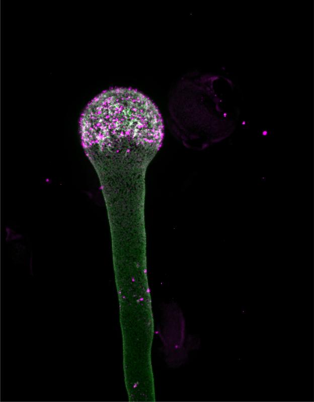 Pollenschlauch mit geschwollener Spitze (Grün: Ein Enzym, das für die Produktion der Lipid-Nanodomänen verantwortlich ist, Magenta: Lipid-Nanodomänen)