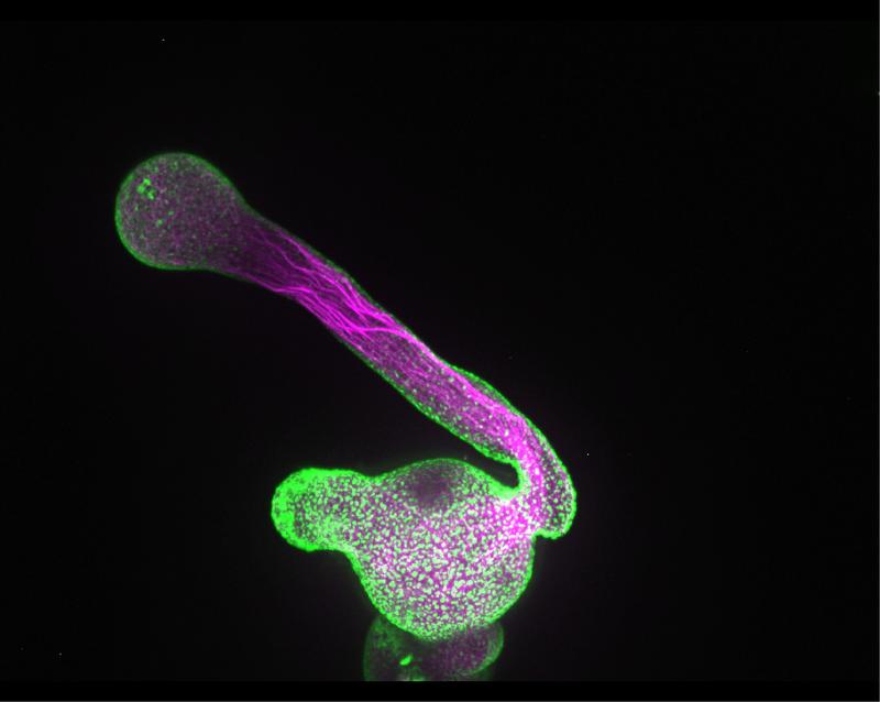 A pollen tube that grows out of a pollen grain (green: one of the enzymes responsible for the production of lipids that control cell growth, magenta: actin cytoskeleton).