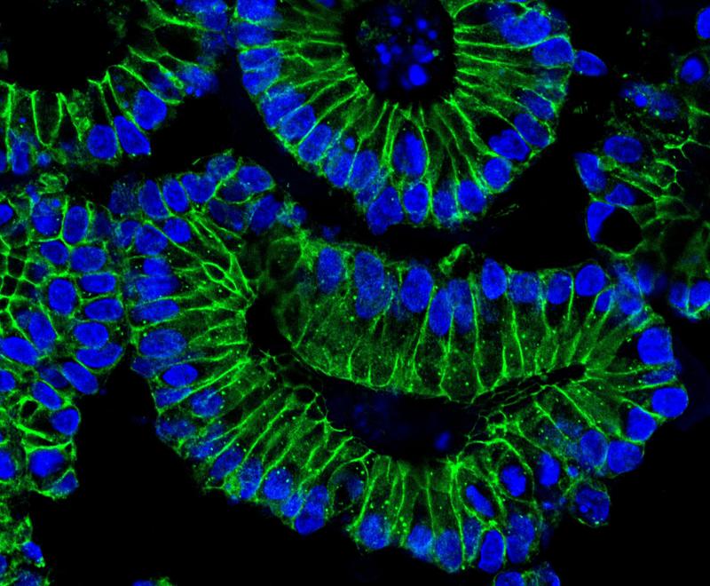 Nach einer Behandlung mit IFN-ƴ lokalisieren sich die Zellkerne (blau) der Epithelzellen am basalen (äußeren) Rand der Organoide. Damit geht eine verstärkte Produktion des Rezeptors ACE2 einher, den SARS-CoV-2 als Einstiegspforte in die Zellen nutzt.