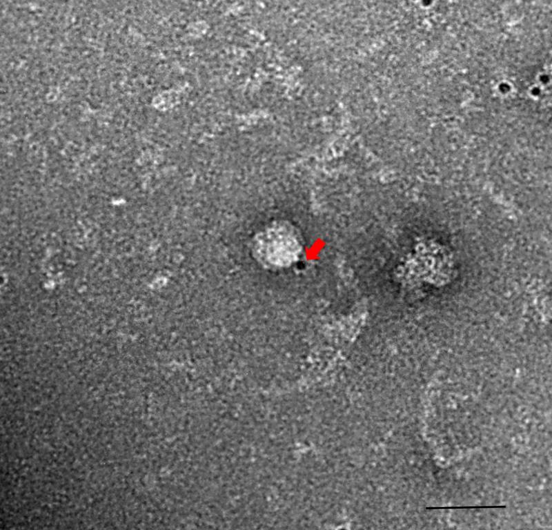 Hepatitis-E-Virus (HEV) im Ejakulat eines chronischen HEV-Patienten. Der Pfeil zeigt auf einen Goldpartikel, der am Virus gebunden hat.