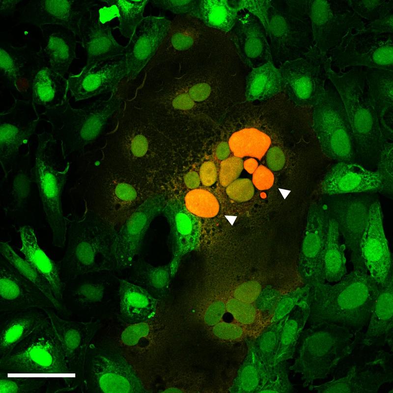Mikroskopische Aufnahme durch Spikeprotein verschmolzene Zellen. Pfeile zeigen auf eine Zusammenlagerung von Zellkernen (orange) mehrerer verschmolzener Zellen.