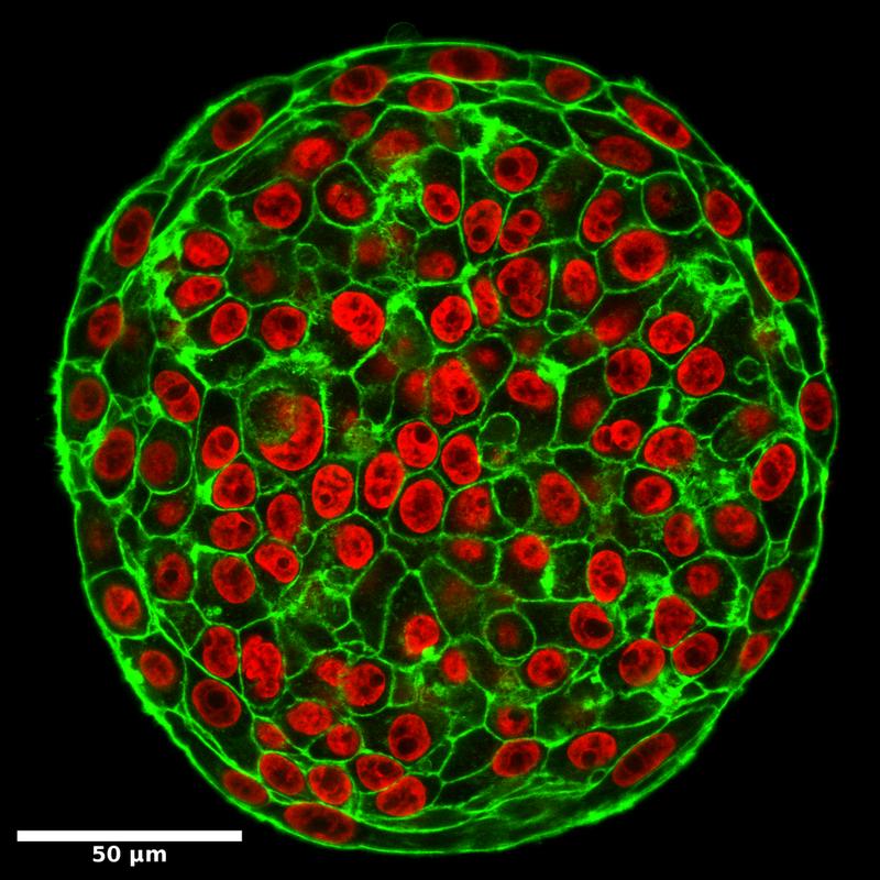 Actin and DNA staining reveal the structure of 3D tumour clusters. Cell shapes in cancer tumours indicate whether cells are motile.