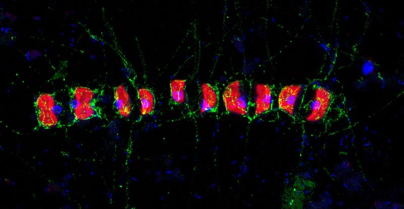 This Airyscan super-resolution image shows that fucose-containing sulphated polysaccharide, or FCSP, (in green) occurred around the cells of the chain-forming diatom Chaetoceros socialis and their spines