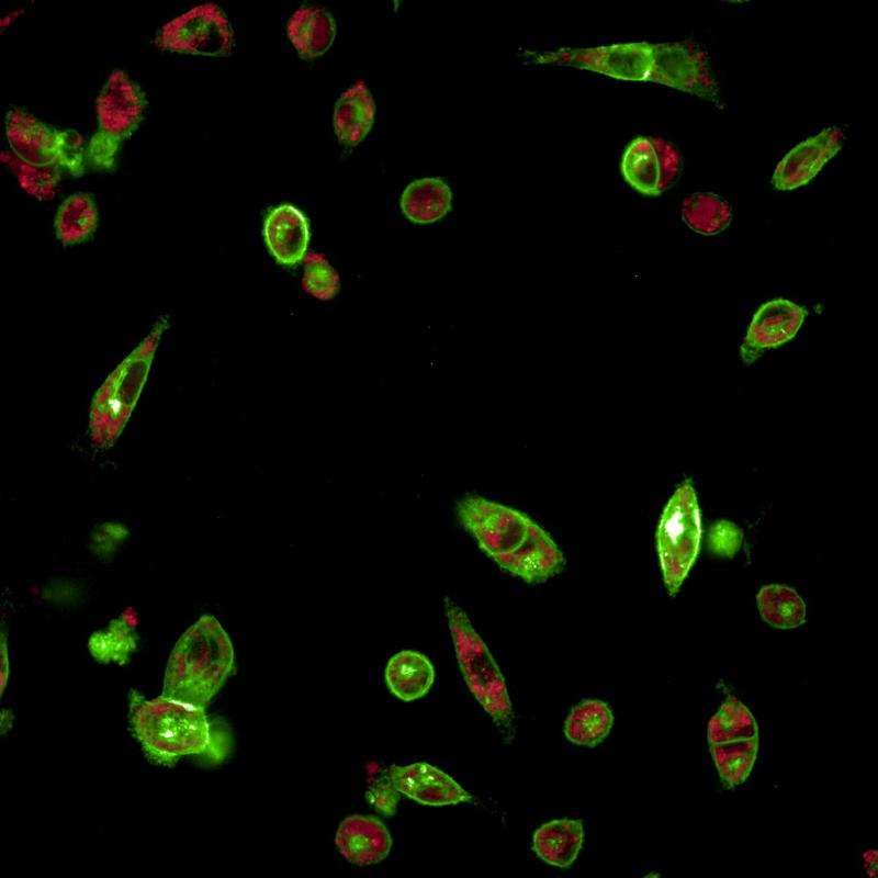 Lungenkrebszellen, die sich vom epithelialen zum mesenchymalen Phänotyp wandeln, sichtbar durch das grüne Fluoreszieren des molekularen Reporters. 