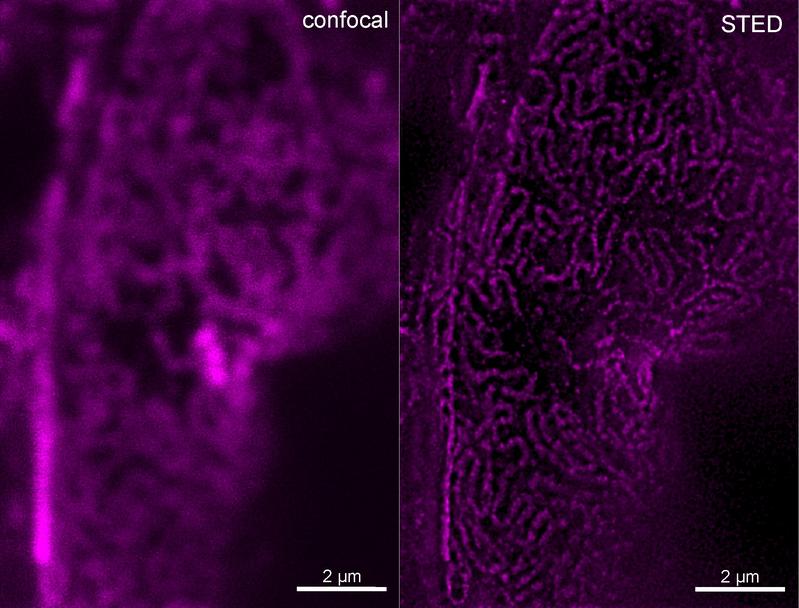 Das STED-Mikroskop liefert scharfe Aufnahmen von Strukturen bis zu 30 Nanometern (r.), hier von der glomerulären Schlitzmembran, einer Filtermembran in der Niere. Herkömmliche konfokale Lichtmikroskope erreichen eine Auflösung von 200 Nanometern (l.).