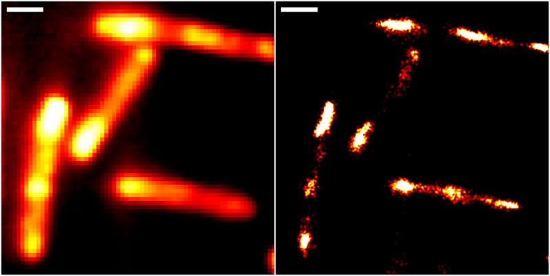 Abbildungen von Darmbakterien mit konventioneller Epifluoreszenzmikroskopie (links) und höchstauflösender Einzelmolekül-Lokalisationsmikroskopie unter Einsatz des neuen RhoBAST-Farbstoff-Marker-Komplexes zur Fluoreszenzmarkierung. Skalenbalken: 1 µm.