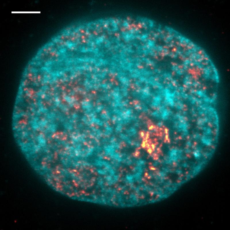 Mittels hochauflösender optischer Mikroskopie aufgenommenes Bild der Transkription in einem Zellkern. DNA ist blau dargestellt, transkribierende Polymerase in gelb. Maßstabsleiste entspricht 2 Mikrometern. 