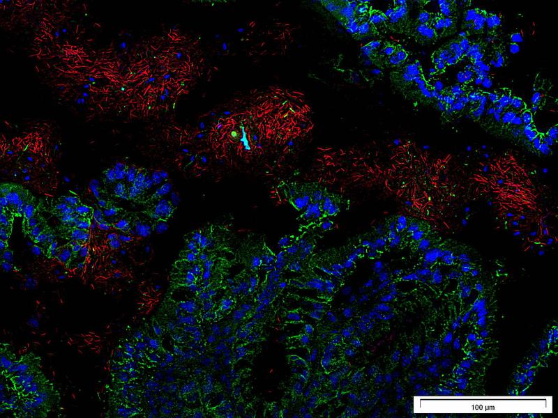 Bacteria (red) in direct contact to cells of the intestinal wall (green, cell nuclei in blue)