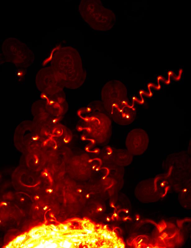 In Gelen, die der Dichte der Säugetierhaut nachempfunden waren, bewegten sich die Erreger in Spiralen, erkennbar an den orange leuchtenden „Kriechspuren“ im rund 0,1 Millimeter dicken Polyacrylamid-Gel. 