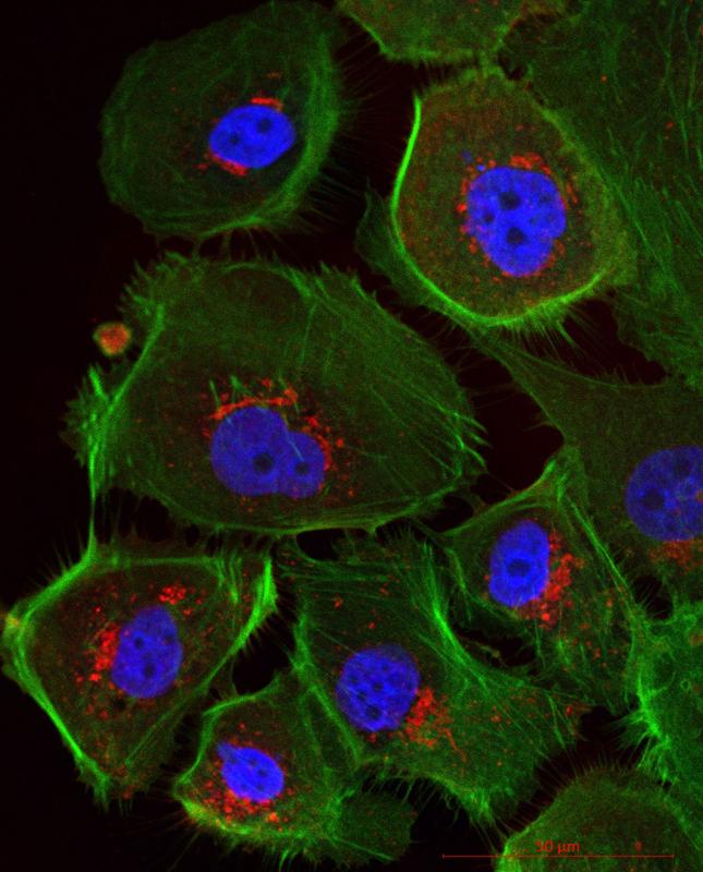 Mikroskopische Ansicht menschlicher Eierstockkrebszellen – durch die Immunfluoreszenzfärbung erscheinen Zellkerne blau und das Zellskelett grün.