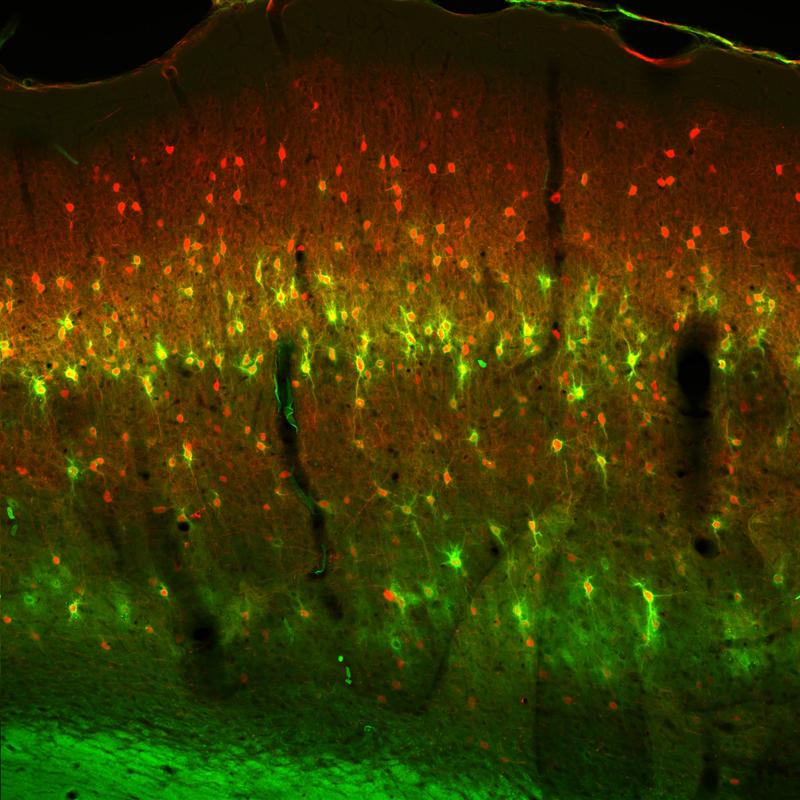 Im histologischen Hirnschnitt wurden Teile der extrazellulären Matrix (grün), die die Nervenzellen (rot) umgibt, angefärbt und unter dem Mikroskop analysiert. 