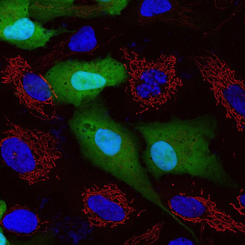 Fluoreszenzkonfokales Bild von kultivierten humanen Zellen. Zu sehen ist die Reaktivierung von HHV-6 (GFP-positive Zellen, grün), die den Verlust von Mitochondrien (rot) verursacht. Die Zellkerne sind blau gefärbt.