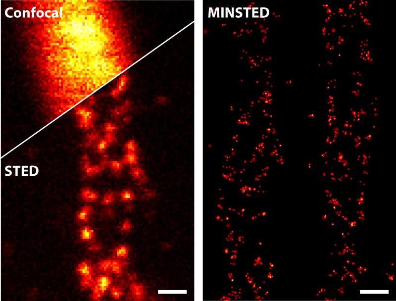 Verschiedene lichtmikroskopische Techniken im Vergleich: Bereits STED (links unten) verbessert die Detailschärfe gegenüber herkömmlicher konfokaler Mikroskopie (links oben) drastisch. MINSTED (rechts) erreicht eine noch mal zehnfach höhere Auflösung. 