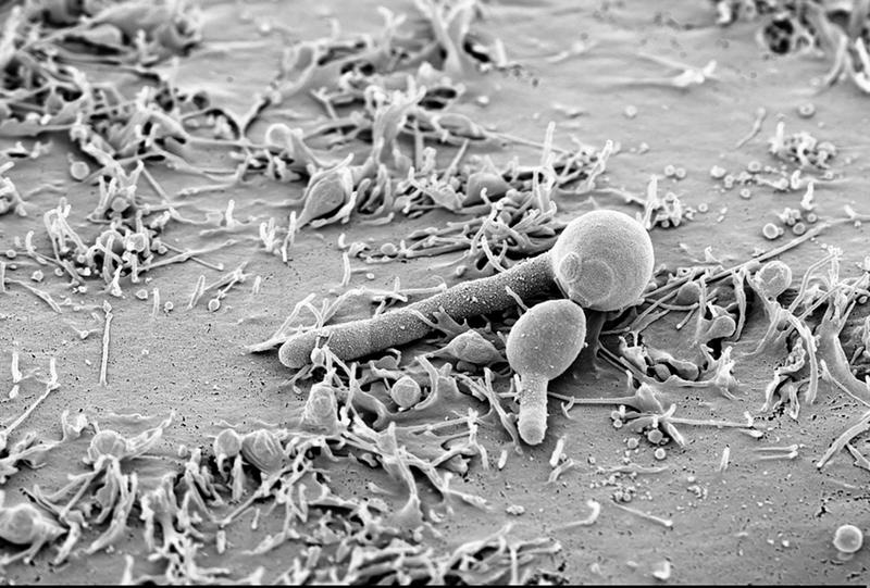 Candida albicans bildet Filamente auf Epithelzellen, die dem Pilz helfen sich anzuheften und Infektionen auszulösen