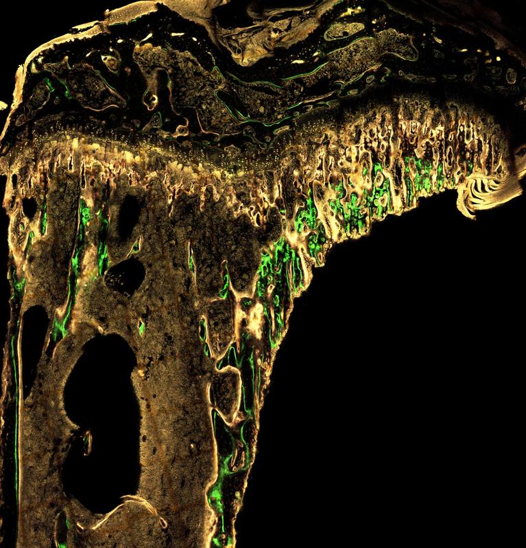 This micrograph shows a bone cross-section labeled with fluorescent dyes to measure the dynamics of bone formation. (Method: dynamic histomorphometry)