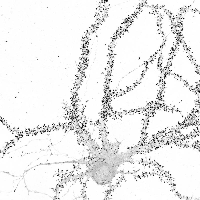 Verfolgung der Echtzeit-Dynamik der Protein-Synthese für endogene Proteine in lebenden Neuronen. Gezeigt: Superauflösendes Airyscan-Bild des endogenen synaptischen Proteins CAMK2a. 
